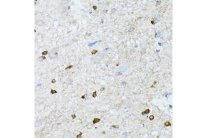 Immunohistochemistry of paraffin-embedded mouse spinal cord using ROCK2 antibody.