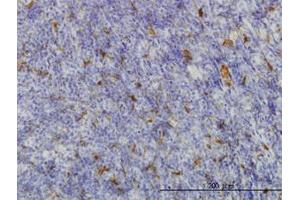 Image no. 1 for anti-Malic Enzyme 1, NADP(+)-Dependent, Cytosolic (ME1) (AA 1-573) antibody (ABIN598801) (ME1 anticorps  (AA 1-573))