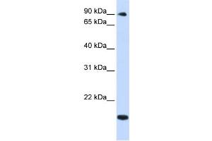 WB Suggested Anti-TSR1 Antibody Titration:  0. (TSR1 anticorps  (Middle Region))