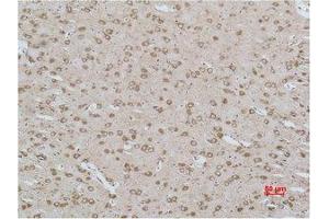 Immunohistochemistry (IHC) analysis of paraffin-embedded Rat Brain Tissue using CACNG3 Polyclonal Antibody. (CACNG3 anticorps)