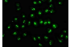 Immunofluorescence staining of Hela cells with ABIN7144976 at 1:333, counter-stained with DAPI. (DDX18 anticorps  (AA 32-110))