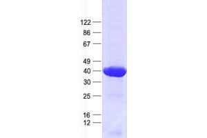 Validation with Western Blot