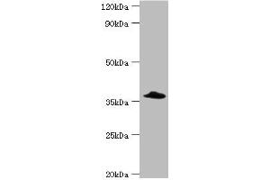Western blot All lanes: Complement factor H-related protein 3 antibody at 6 μg/mL + Rat heart tissue Secondary Goat polyclonal to rabbit IgG at 1/10000 dilution Predicted band size: 38, 31 kDa Observed band size: 38 kDa (CFHR3 anticorps  (AA 80-200))