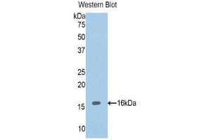 Western Blotting (WB) image for anti-ADAM Metallopeptidase with Thrombospondin Type 1 Motif, 1 (ADAMTS1) (AA 854-967) antibody (ABIN1857898) (ADAMTS1 anticorps  (AA 854-967))