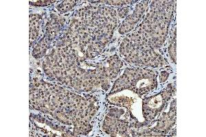 IHC analysis of hnRNP L/HNRNPL using anti-hnRNP L/HNRNPL antibody (ABIN7600130). (HNRNPL anticorps  (AA 152-569))