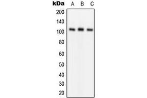 Western blot analysis of GLUR1 (pS849) expression in Jurkat (A), mouse kidney (B), rat liver (C) whole cell lysates. (Glutamate Receptor 1 anticorps  (C-Term, pSer849))