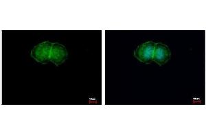 ICC/IF Image L-Plastin antibody detects LCP1 protein at membrane by immunofluorescent analysis. (LCP1 anticorps)