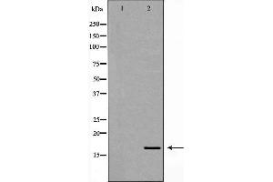 Western blot analysis of 293T whole cell lysates, using NPC2 Antibody. (NPC2 anticorps  (N-Term))