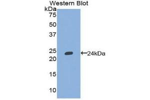 Western Blotting (WB) image for anti-Tumor Necrosis Factor (Ligand) Superfamily, Member 13 (TNFSF13) (AA 92-250) antibody (ABIN1174977)