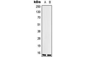 Western blot analysis of LSM1 expression in Hela (A), HEK293T (B) whole cell lysates. (LSM1 anticorps  (Center))