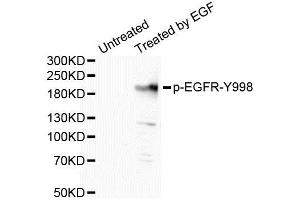 Western Blotting (WB) image for anti-Epidermal Growth Factor Receptor (EGFR) (pTyr998) antibody (ABIN1870110) (EGFR anticorps  (pTyr998))