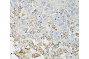 Immunohistochemistry of paraffin-embedded Rat liver using TROVE2 Polyclonal Antibody at dilution of 1:100 (40x lens). (TROVE2 anticorps)