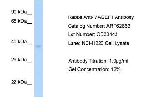 Western Blotting (WB) image for anti-Melanoma Antigen Family F, 1 (MAGEF1) (C-Term) antibody (ABIN2789272) (MAGEF1 anticorps  (C-Term))