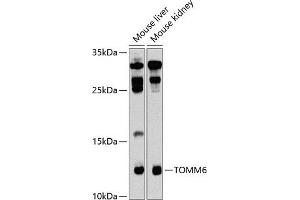 Western blot analysis of extracts of various cell lines, using TOMM6 antibody  at 1:1000 dilution.