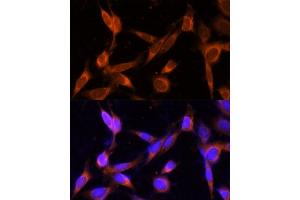 Immunofluorescence analysis of NIH-3T3 cells using VMP1 Polyclonal Antibody (ABIN7271283) at dilution of 1:100 (40x lens).