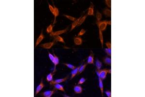 Immunofluorescence analysis of NIH-3T3 cells using VMP1 Polyclonal Antibody (ABIN7271283) at dilution of 1:100 (40x lens). (VMP1 anticorps  (C-Term))