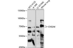 Western blot analysis of extracts of various cell lines, using CNG antibody (ABIN7266548) at 1:1000 dilution. (CNGA4 anticorps  (AA 416-575))
