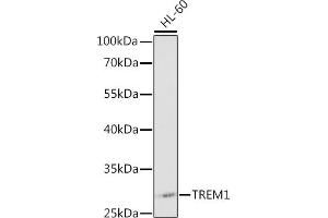 Western blot analysis of extracts of HL-60 cells, using TREM1 antibody (ABIN3020894, ABIN3020895, ABIN3020896 and ABIN6213780) at 1:1000 dilution. (TREM1 anticorps  (AA 21-130))