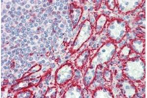 Human Spleen: Formalin-Fixed, Paraffin-Embedded (FFPE)