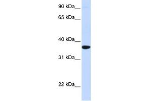 SCGN antibody used at 1 ug/ml to detect target protein. (SCGN anticorps  (Middle Region))