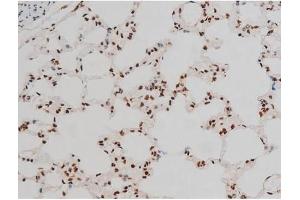 ABIN6267389 at 1/200 staining Rat lung tissue sections by IHC-P.