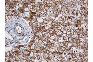 Image no. 12 for anti-SERPINE1 mRNA Binding Protein 1 (SERBP1) (AA 1-262) antibody (ABIN1490675)