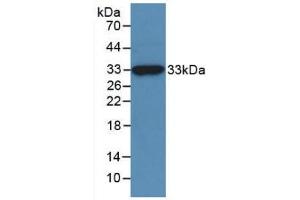 Western blot analysis of recombinant Human NAGase. (MGEA5 anticorps  (AA 6-240))