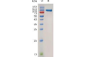 Human (20-707) Protein, His Tag on SDS-PAGE under reducing condition.