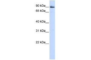 WB Suggested Anti-PCSK5 Antibody Titration:  0. (PCSK5 anticorps  (Middle Region))