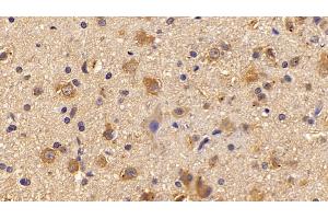 Detection of PNMA2 in Rat Cerebrum Tissue using Polyclonal Antibody to Paraneoplastic Antigen MA2 (PNMA2)