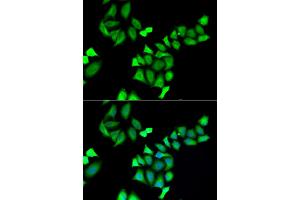 Immunofluorescence analysis of A549 cells using GALE antibody. (GALE anticorps)