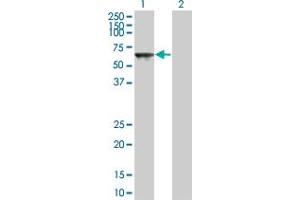Western Blot analysis of TOE1 expression in transfected 293T cell line by TOE1 monoclonal antibody (M03A), clone 1D4. (TOE1 anticorps  (AA 1-510))