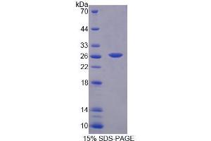 SDS-PAGE analysis of Mouse BCAT1 Protein. (BCAT1 Protéine)