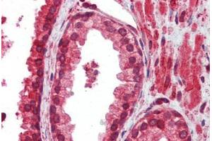 Human Prostate (formalin-fixed, paraffin-embedded) stained with ATF4 antibody ABIN462203 followed by biotinylated goat anti-rabbit IgG secondary antibody ABIN481713, alkaline phosphatase-streptavidin and chromogen.