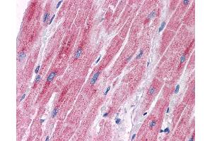 Immunohistochemistry (IHC) image for anti-Pyruvate Dehydrogenase Kinase, Isozyme 2 (PDK2) (Middle Region) antibody (ABIN2777433)