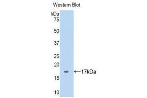 Western Blotting (WB) image for anti-Serpin Peptidase Inhibitor, Clade G (C1 Inhibitor), Member 1 (SERPING1) (AA 399-500) antibody (ABIN3201845) (SERPING1 anticorps  (AA 399-500))