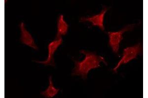 ABIN6275769 staining HeLa by IF/ICC. (IL11RA anticorps  (C-Term))