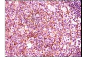 Immunohistochemistry (IHC) image for anti-Dynamin 1 (DNM1) (truncated) antibody (ABIN2464046)