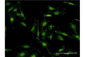 Immunofluorescence of monoclonal antibody to RNF40 on HeLa cell.