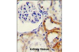 HYAL2 Antibody immunohistochemistry analysis in formalin fixed and paraffin embedded human kidney tissue followed by peroxidase conjugation of the secondary antibody and DAB staining.