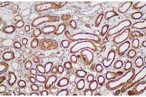 Immunohistochemistry of paraffin-embedded Human kidney using SERPINB2 Polycloanl Antibody at dilution of 1:200