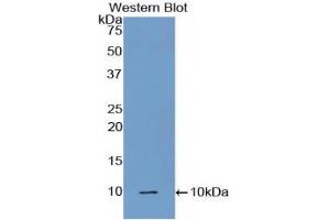 Western blot analysis of the recombinant protein. (C5A anticorps  (AA 679-755))