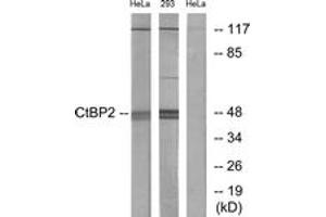 Western blot analysis of extracts from HeLa/293 cells, using CtBP2 Antibody. (CTBP2 anticorps  (AA 396-445))