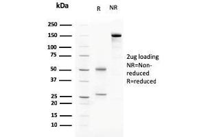 SDS-PAGE Analysis Purified C1QA Mouse Monoclonal Antibody (C1QA/2783). (C1QA anticorps  (AA 104-237))