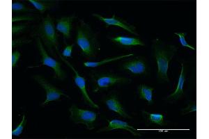 Immunofluorescence of purified MaxPab antibody to NQO2 on HeLa cell. (NQO2 anticorps  (AA 1-231))