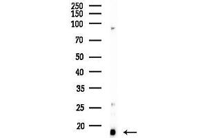 anti-Cyclin-Dependent Kinase 2 Associated Protein 1 (CDK2AP1) (C-Term) antibody