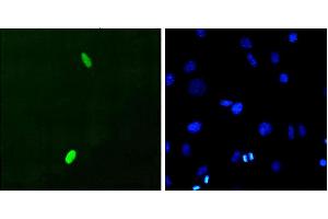 Immunocytochemistry/Immunofluorescence analysis using Mouse Anti-DUX4 Monoclonal Antibody, Clone P2B1 . (DUX4 anticorps  (C-Term) (PerCP))