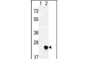 Western blot analysis of MSRB2 (arrow) using rabbit polyclonal MSRB2 Antibody (Center) (ABIN390968 and ABIN2841148). (MSRB2 anticorps  (AA 44-73))