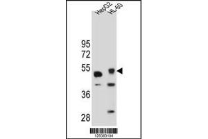 Western blot analysis in HepG2 and HL-60 cell line lysates (35ug/lane). (TIGD3 anticorps  (C-Term))