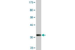 Western Blot detection against Immunogen (36. (GOLM1 anticorps  (AA 302-401))